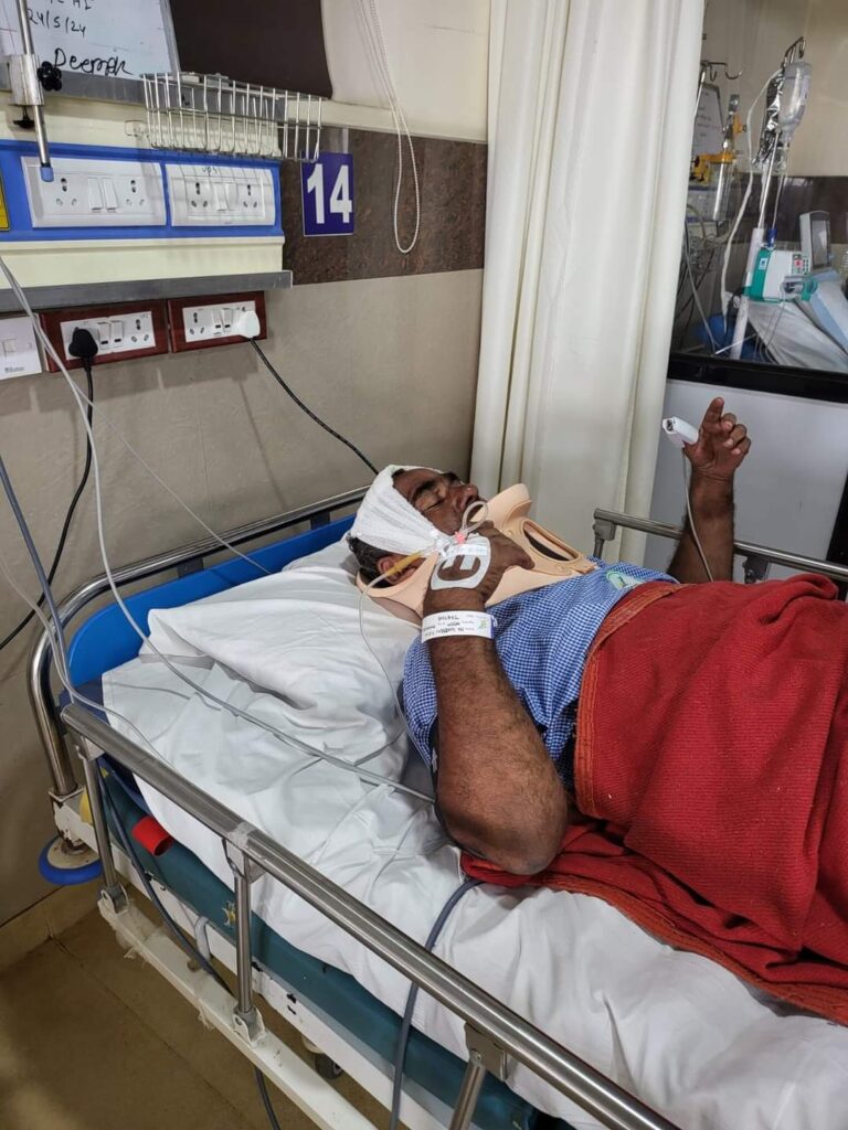 पुलिस हवलदार का हुआ एक्सीडेंट/accident news/raipur/रायपुर 